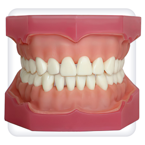 Model of the upper and lower jams with 32 intact teeth for anesthesia