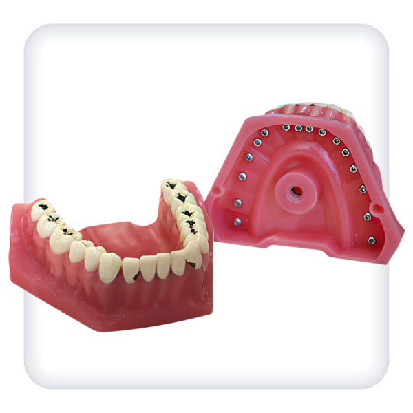 Model of the upper and lower jams with 32 model teeth for caries treatment