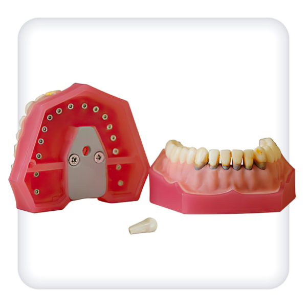 Model of the upper and lower jams with 32 model teeth for periodontal disease treatment