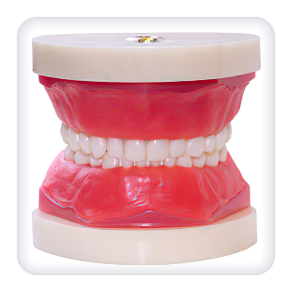 Model of the upper and lower jaws with 24 intact teeth of a removable bite