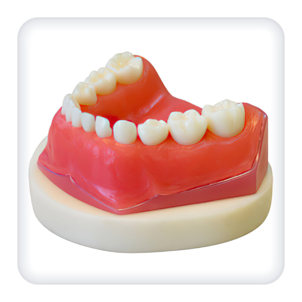 Model of the upper and lower jaws with 24 intact teeth of a removable bite