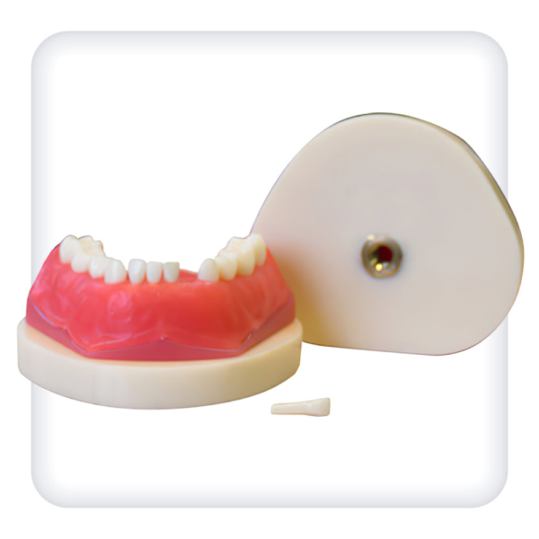 Model of the upper and lower jaws with 24 intact teeth of a removable bite