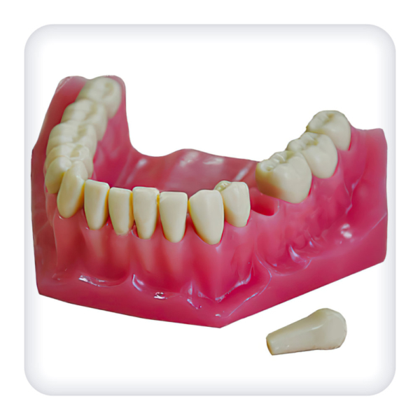 Model of the upper and lower jaws with 32 intact teeth