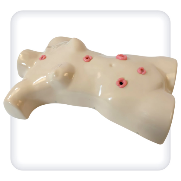 Torso phantom for stoma treatment