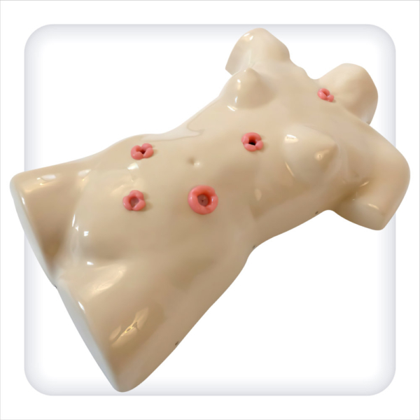 Torso phantom for stoma treatment