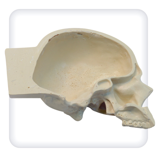 Skull model for practicing trepanation skills