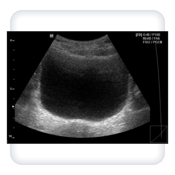 Simulator for practicing cystostomy skills under ultrasound control